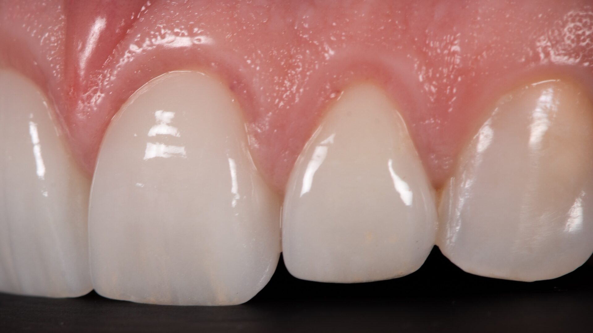 Eirini Zampara Clinical Cases