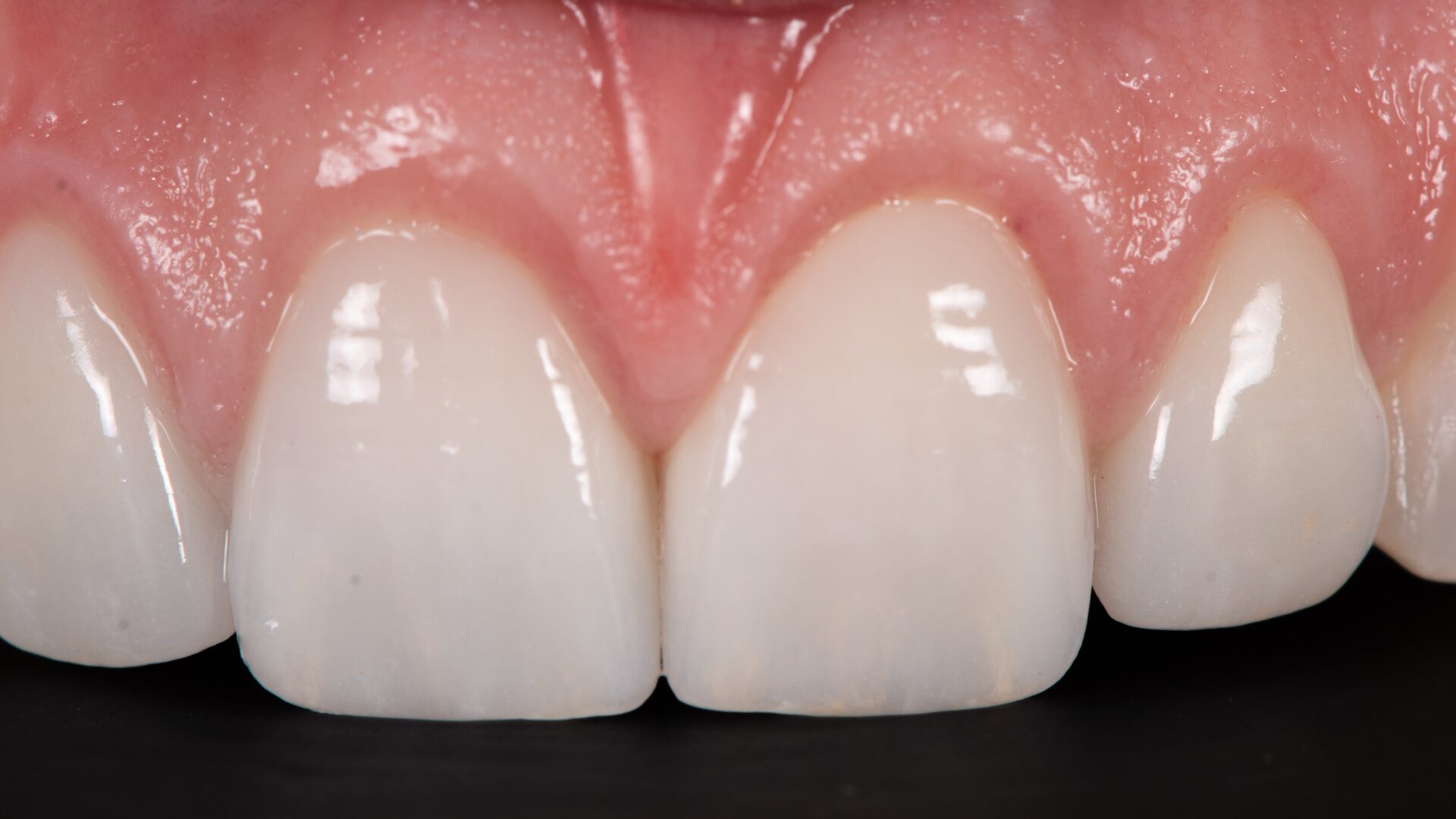 Eirini Zampara Clinical Cases