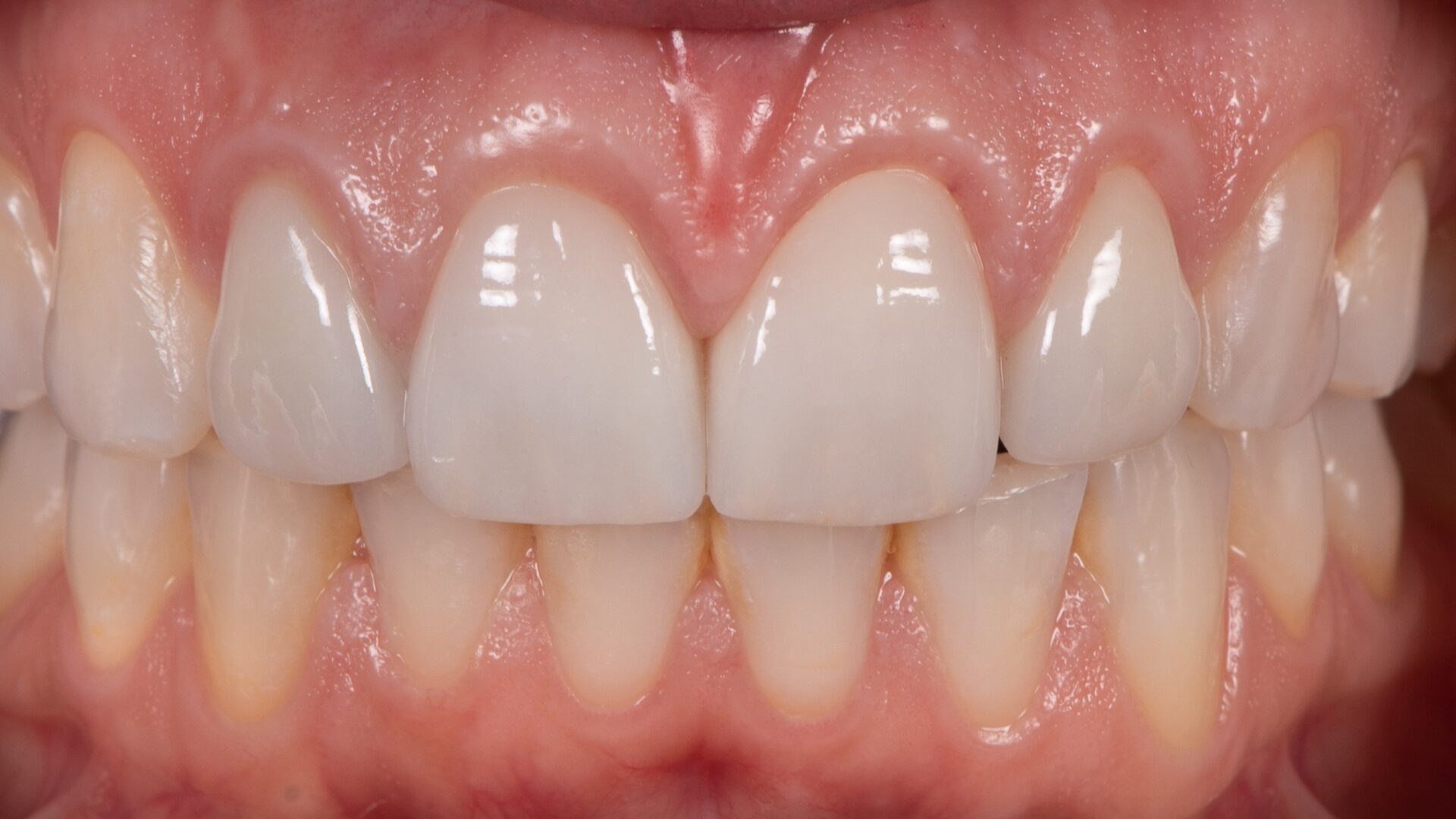 Eirini Zampara Clinical Cases