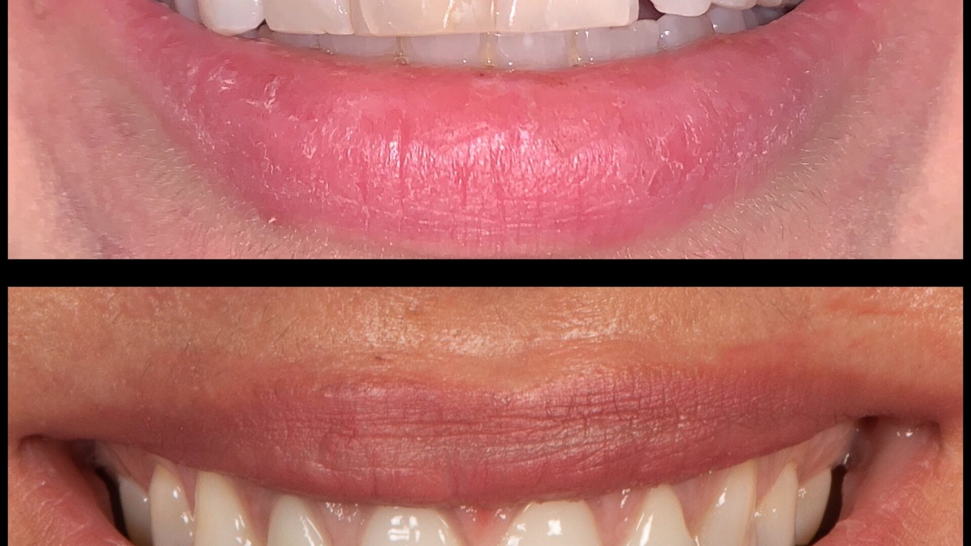 Eirini Zampara Clinical Cases