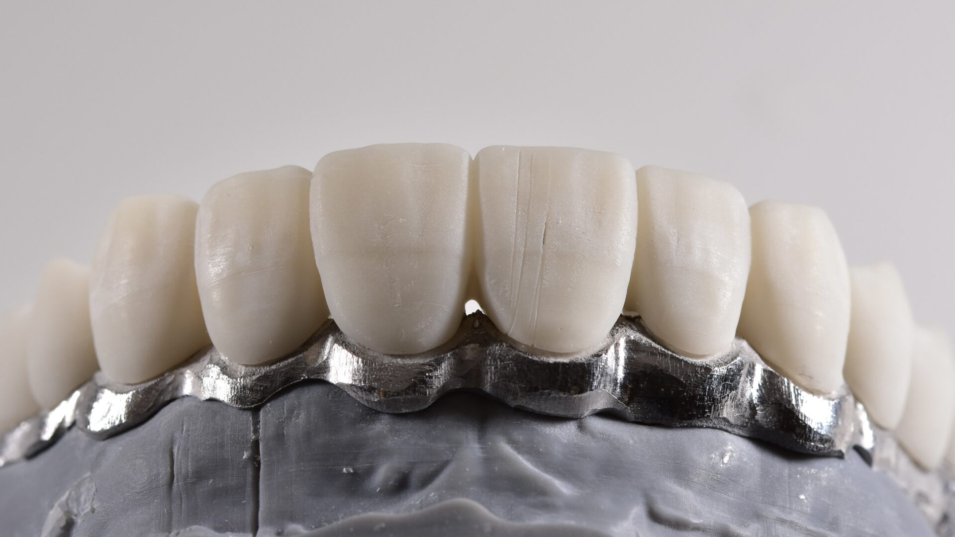 Eirini Zampara Clinical Cases