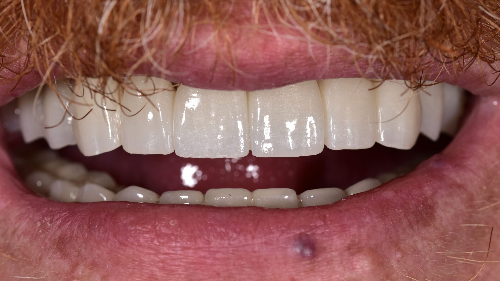 Eirini Zampara Clinical Cases