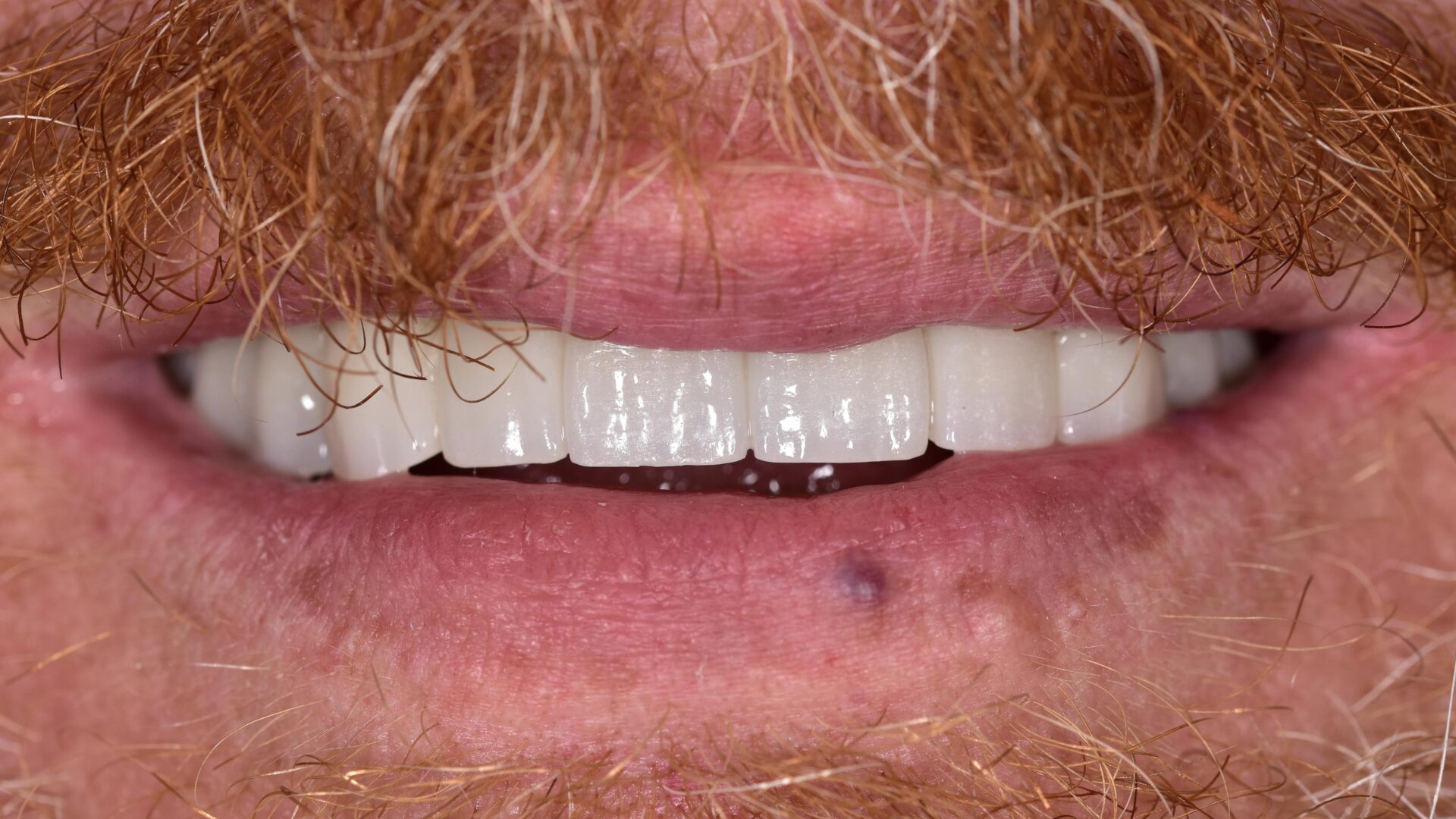 Eirini Zampara Clinical Cases