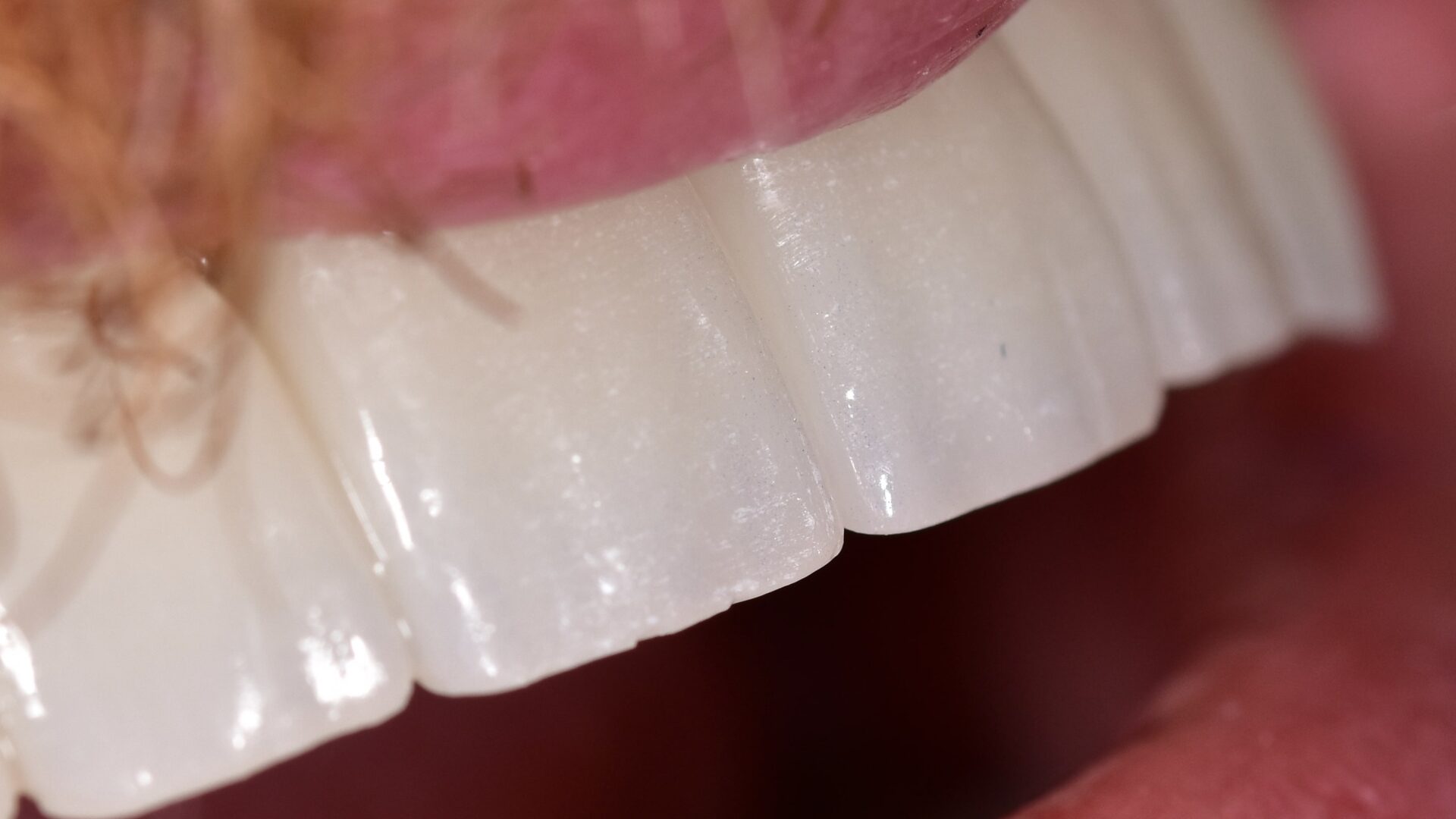 Eirini Zampara Clinical Cases