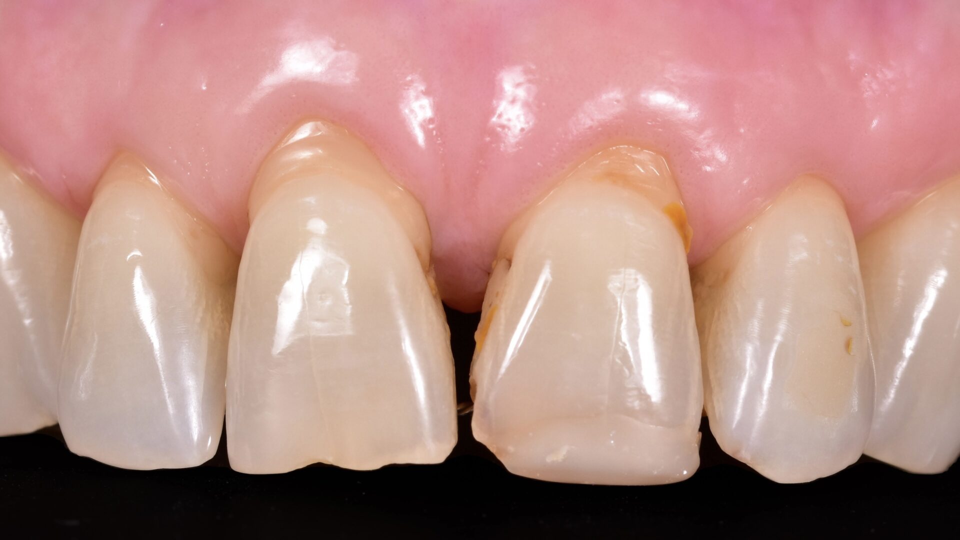 Eirini Zampara Clinical Cases