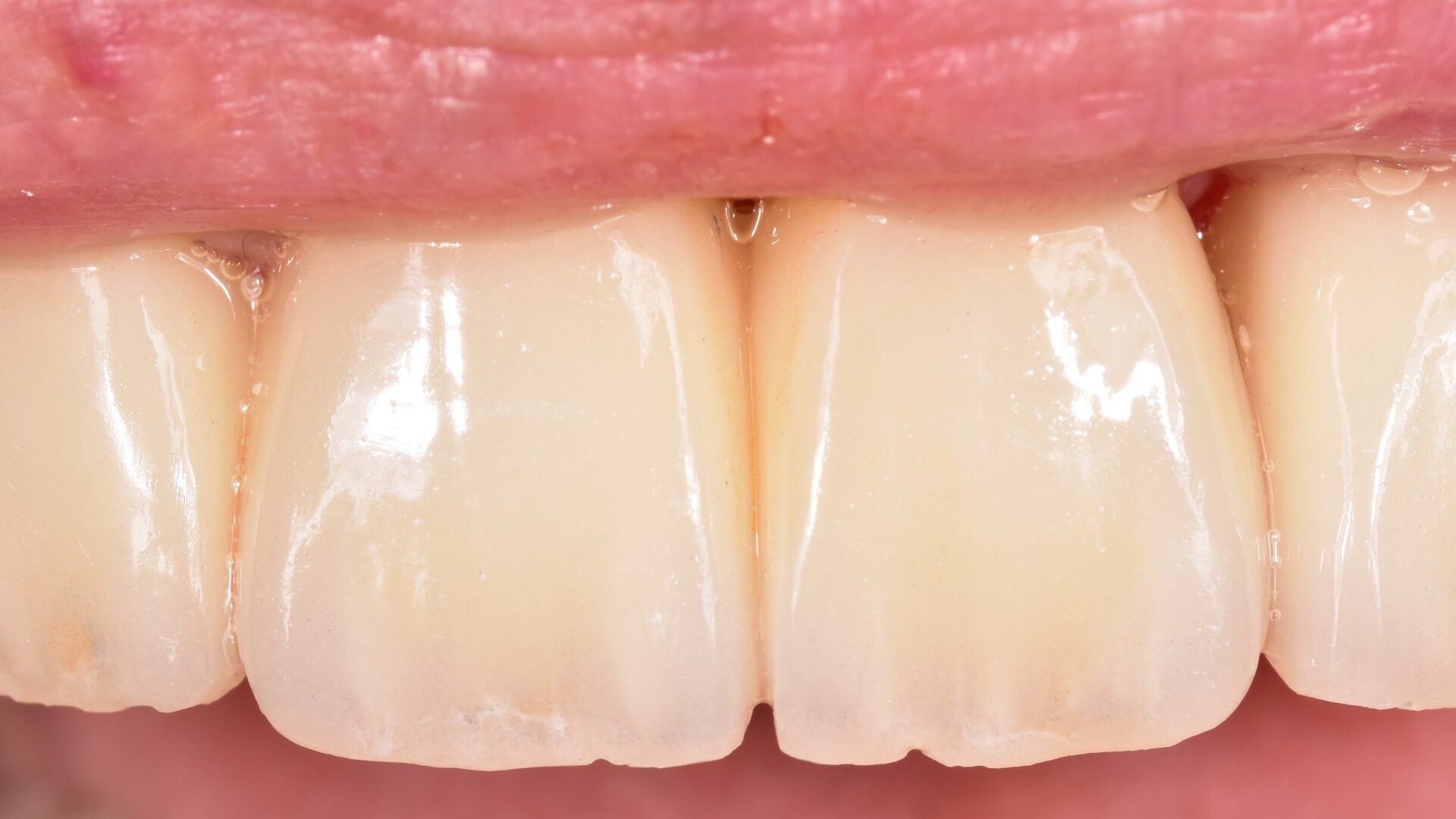 Eirini Zampara Clinical Cases