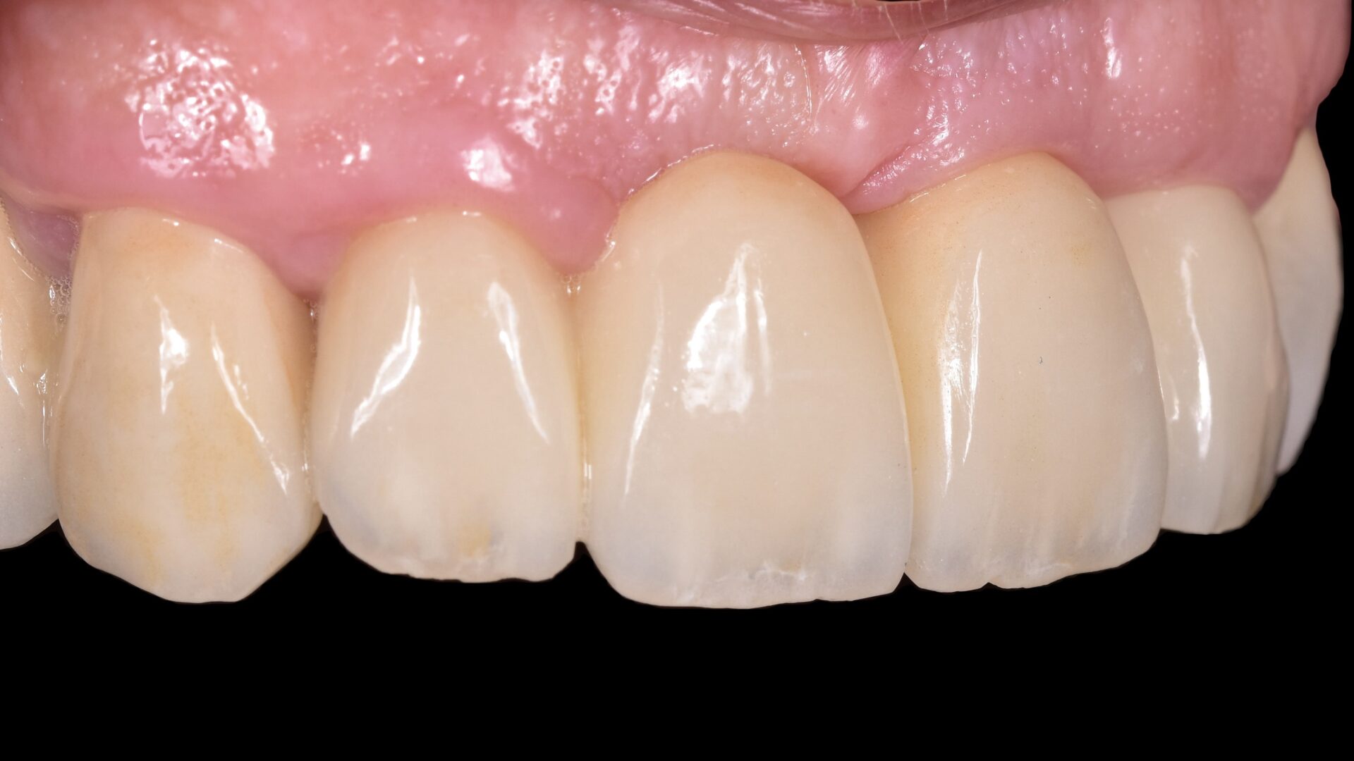 Eirini Zampara Clinical Cases