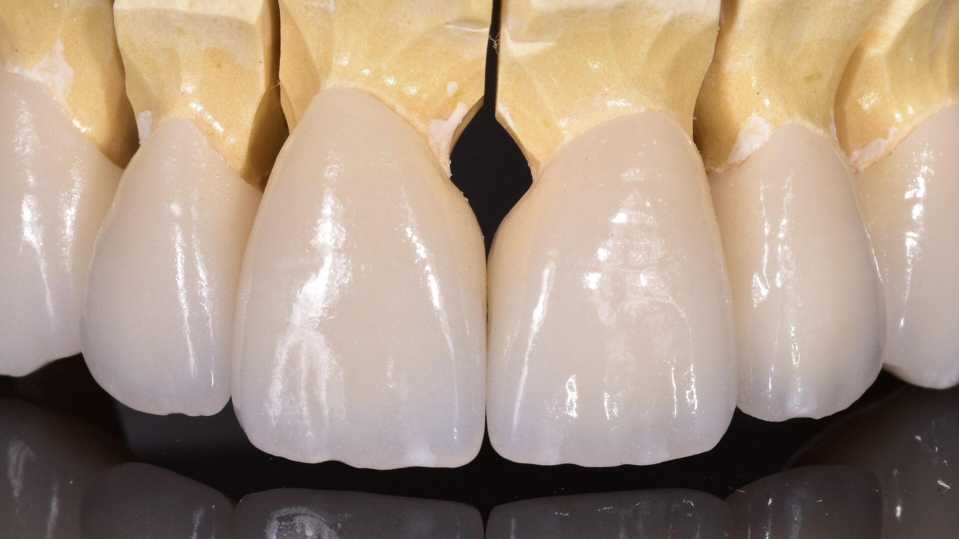 Eirini Zampara Clinical Cases