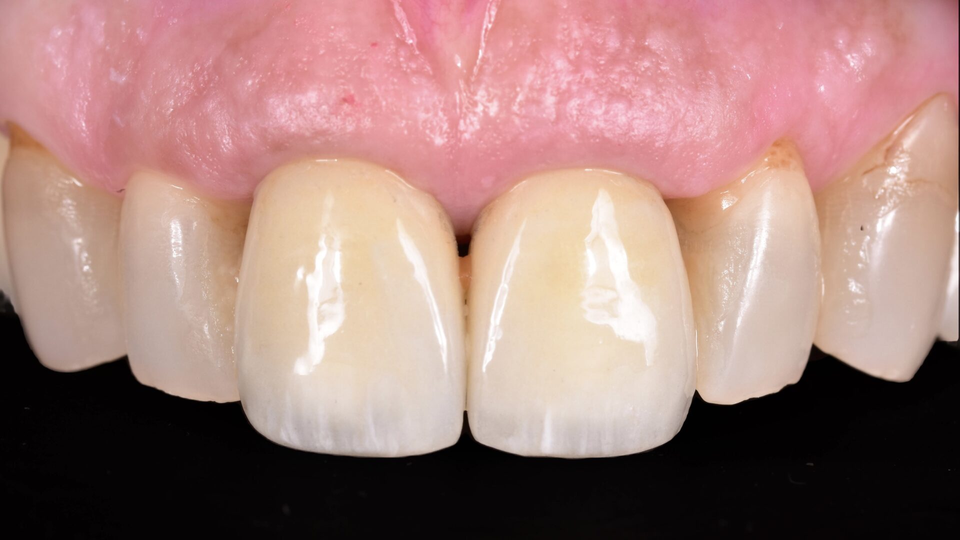 Eirini Zampara Clinical Cases