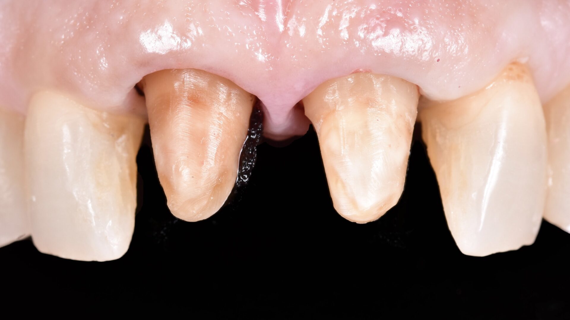 Eirini Zampara Clinical Cases