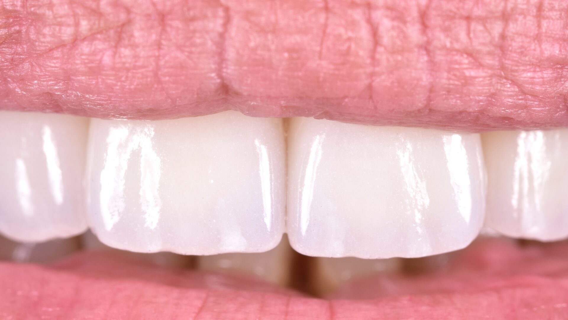 Eirini Zampara Clinical Cases