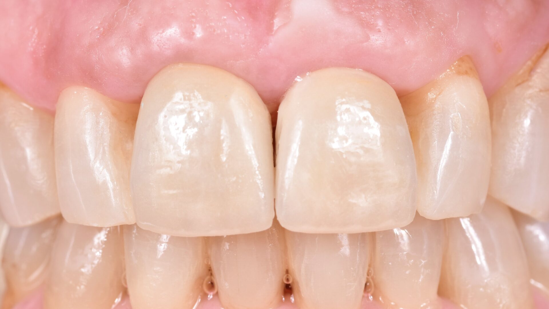 Eirini Zampara Clinical Cases