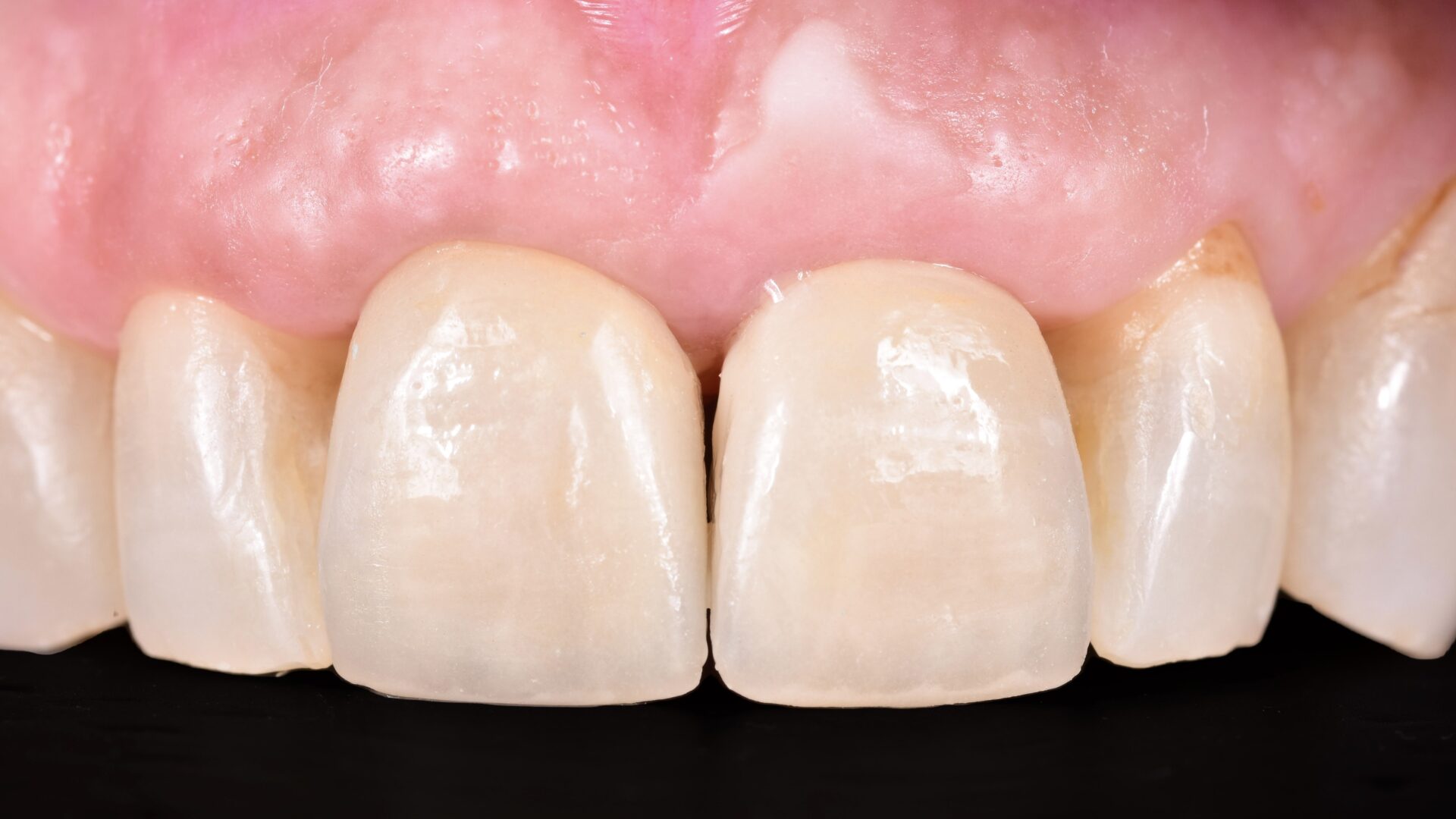 Eirini Zampara Clinical Cases