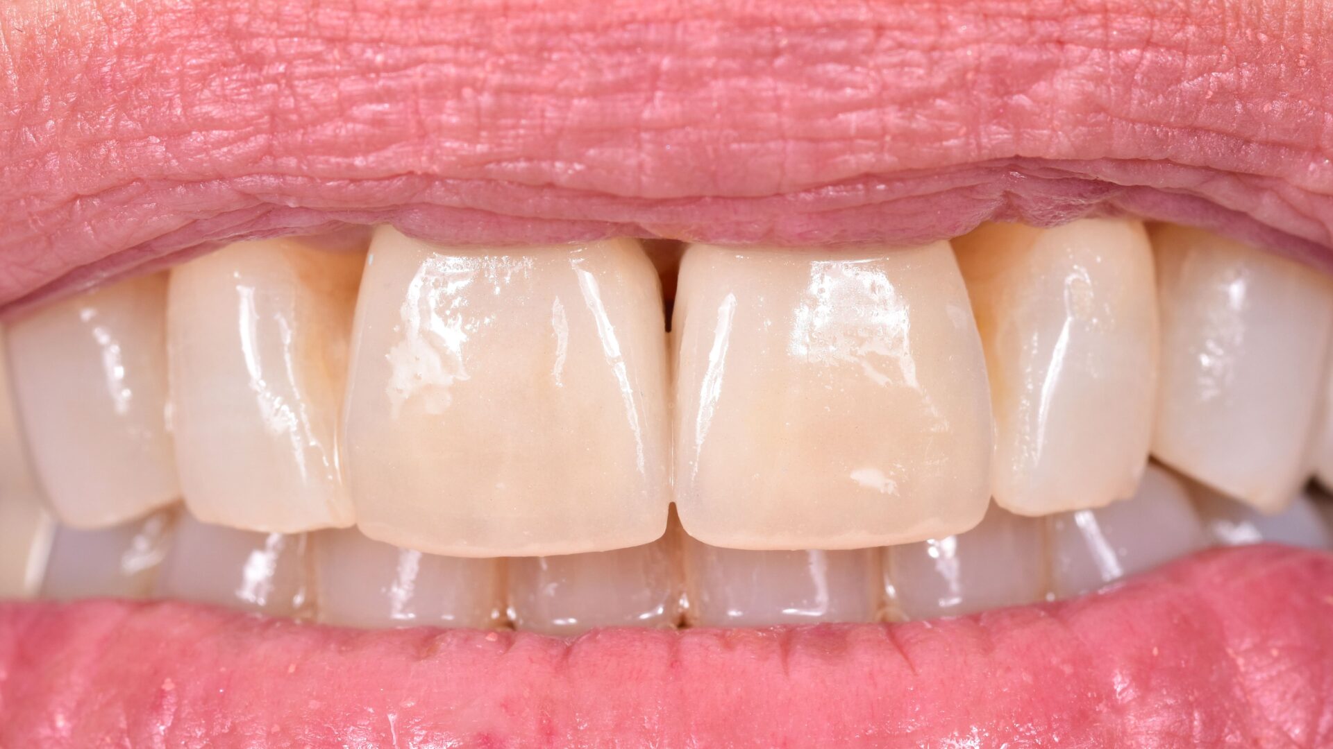 Eirini Zampara Clinical Cases