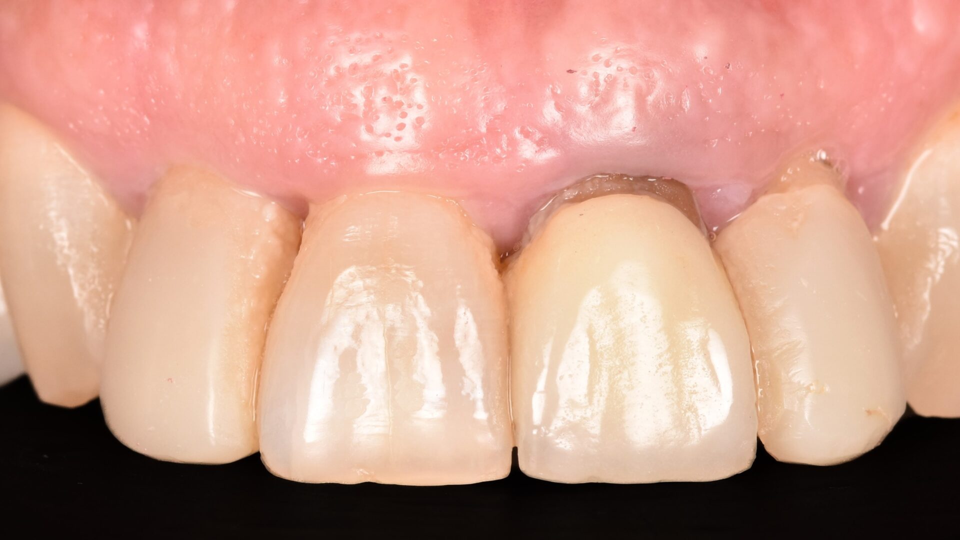 Eirini Zampara Clinical Cases