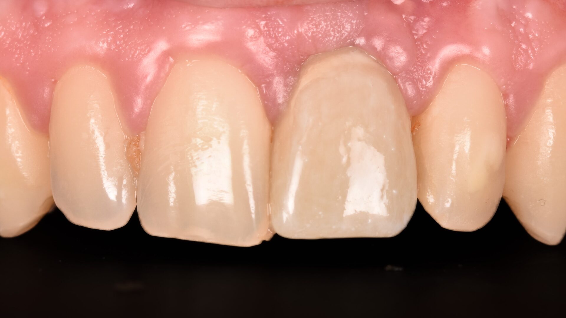 Eirini Zampara Clinical Cases