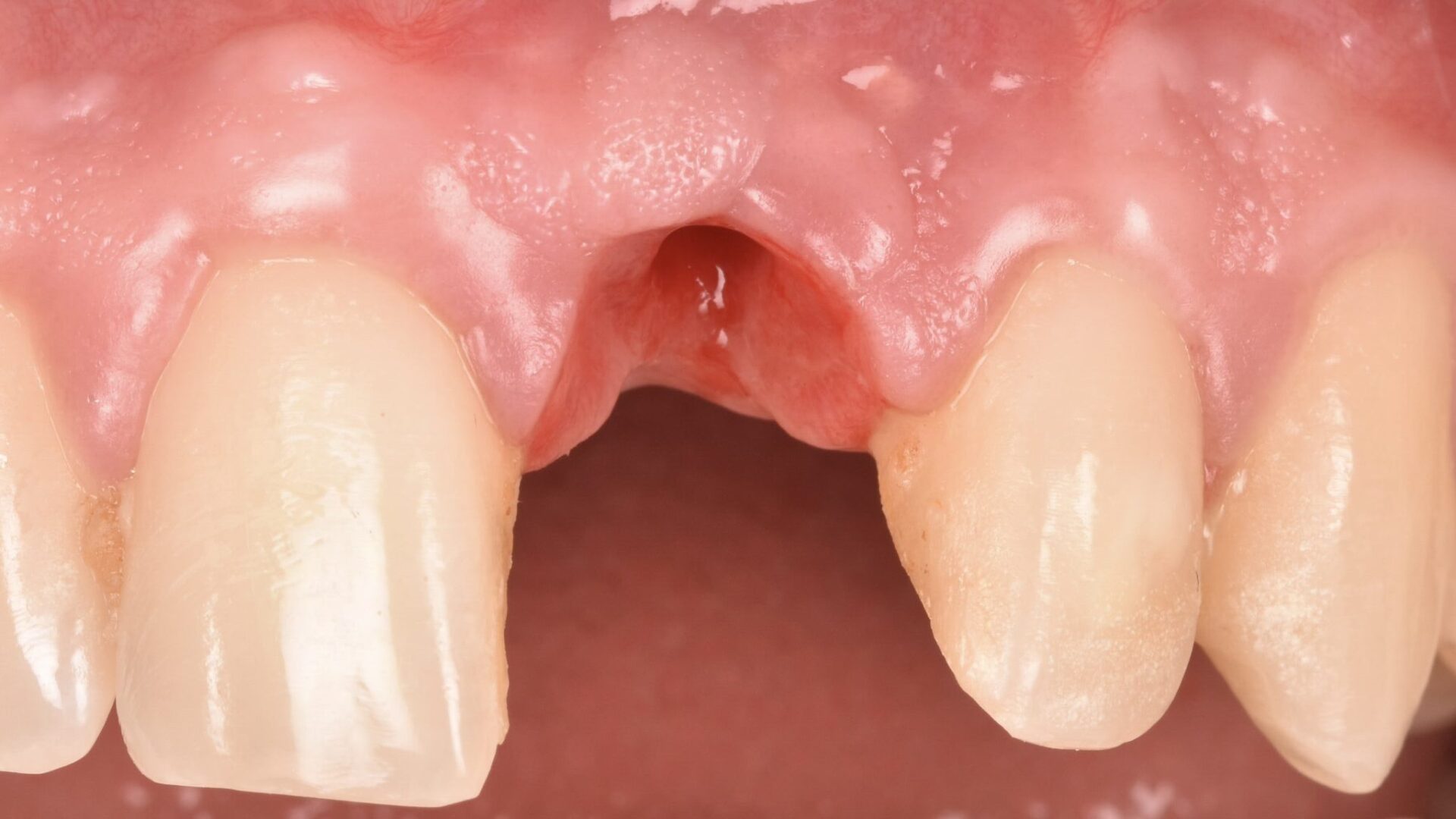 Eirini Zampara Clinical Cases