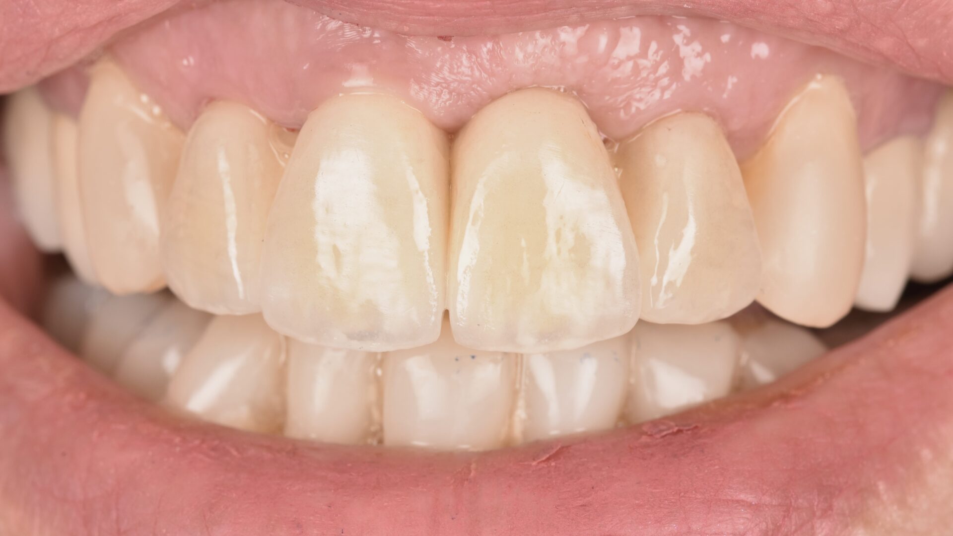 Eirini Zampara Clinical Cases