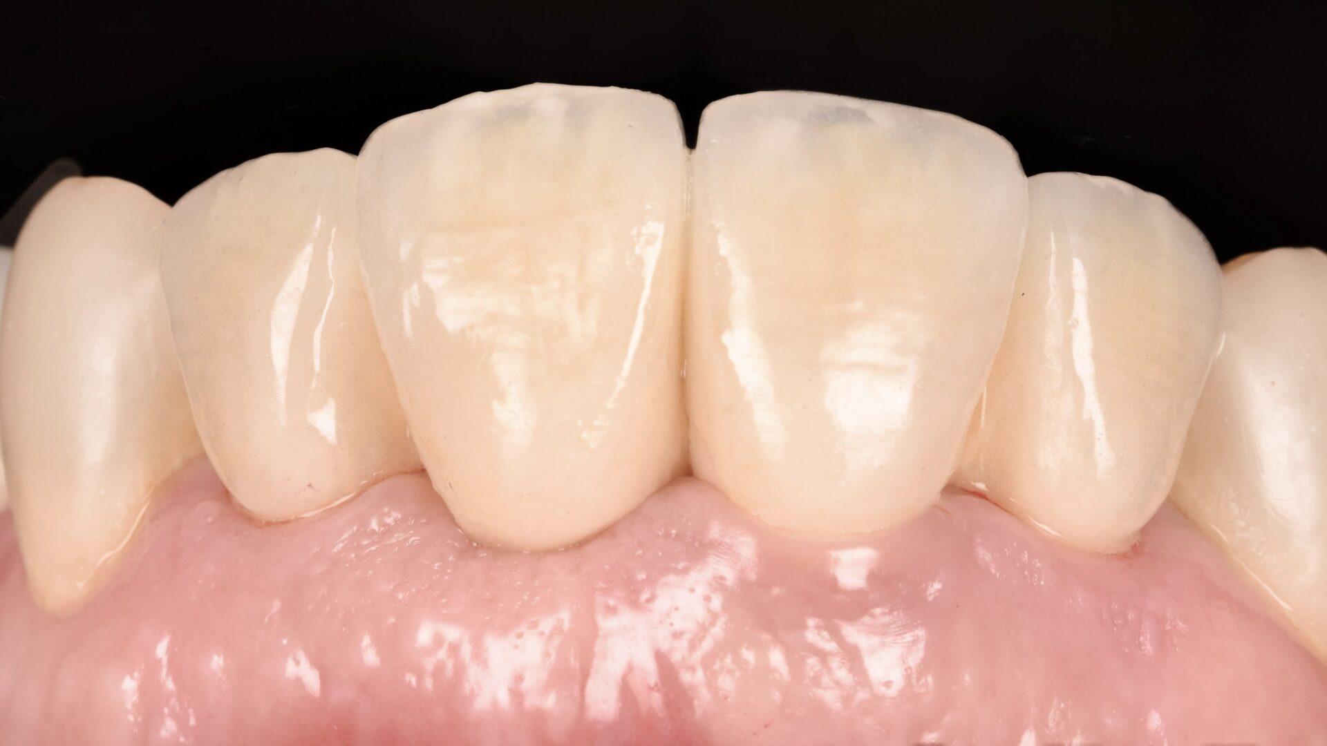 Eirini Zampara Clinical Cases