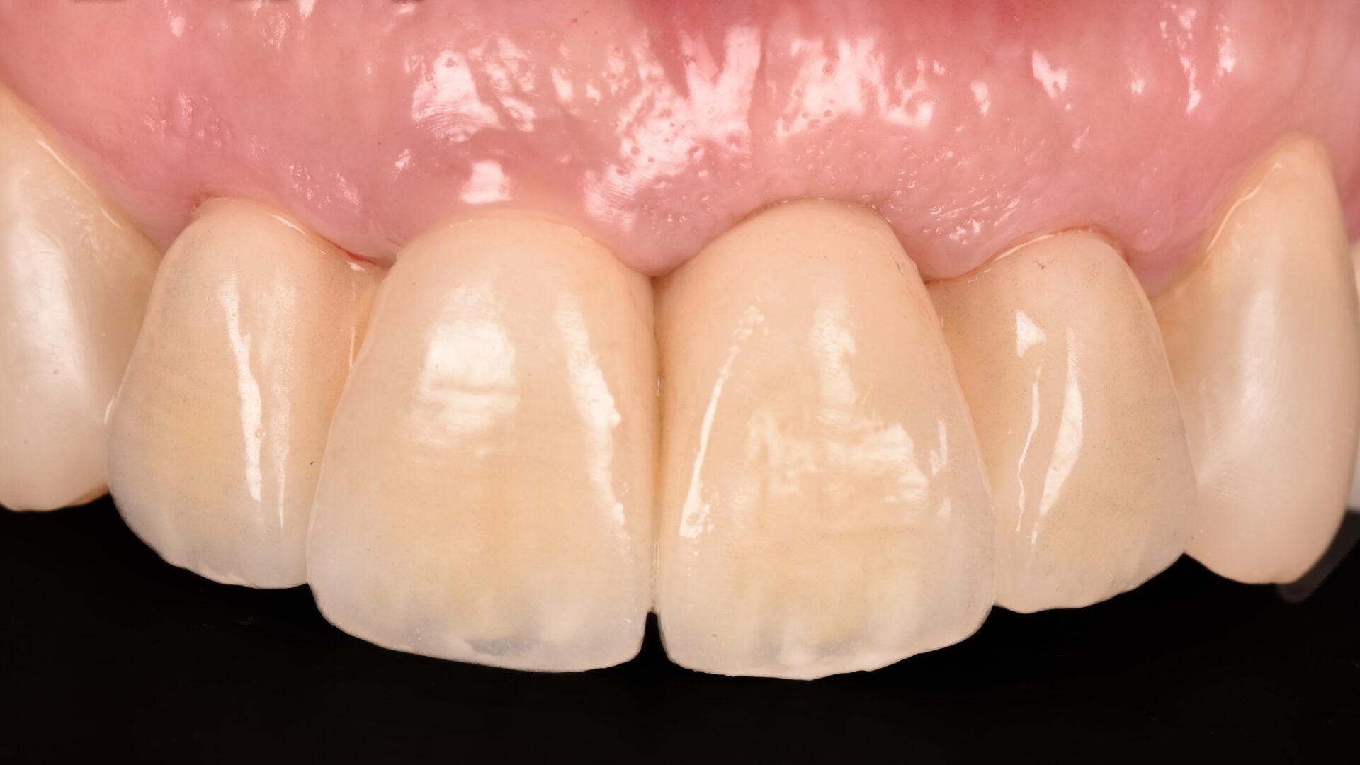 Eirini Zampara Clinical Cases