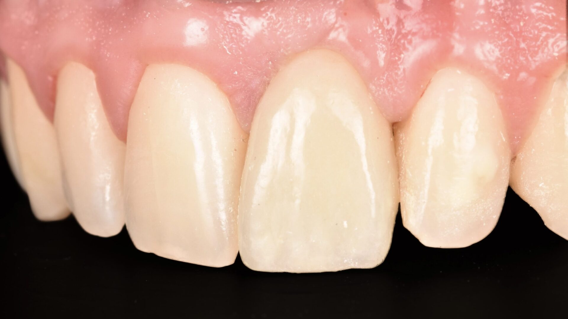 Eirini Zampara Clinical Cases