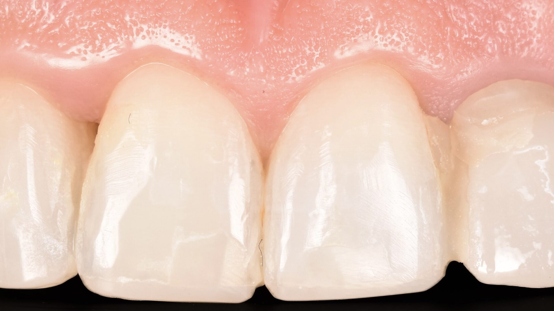 Eirini Zampara Clinical Cases