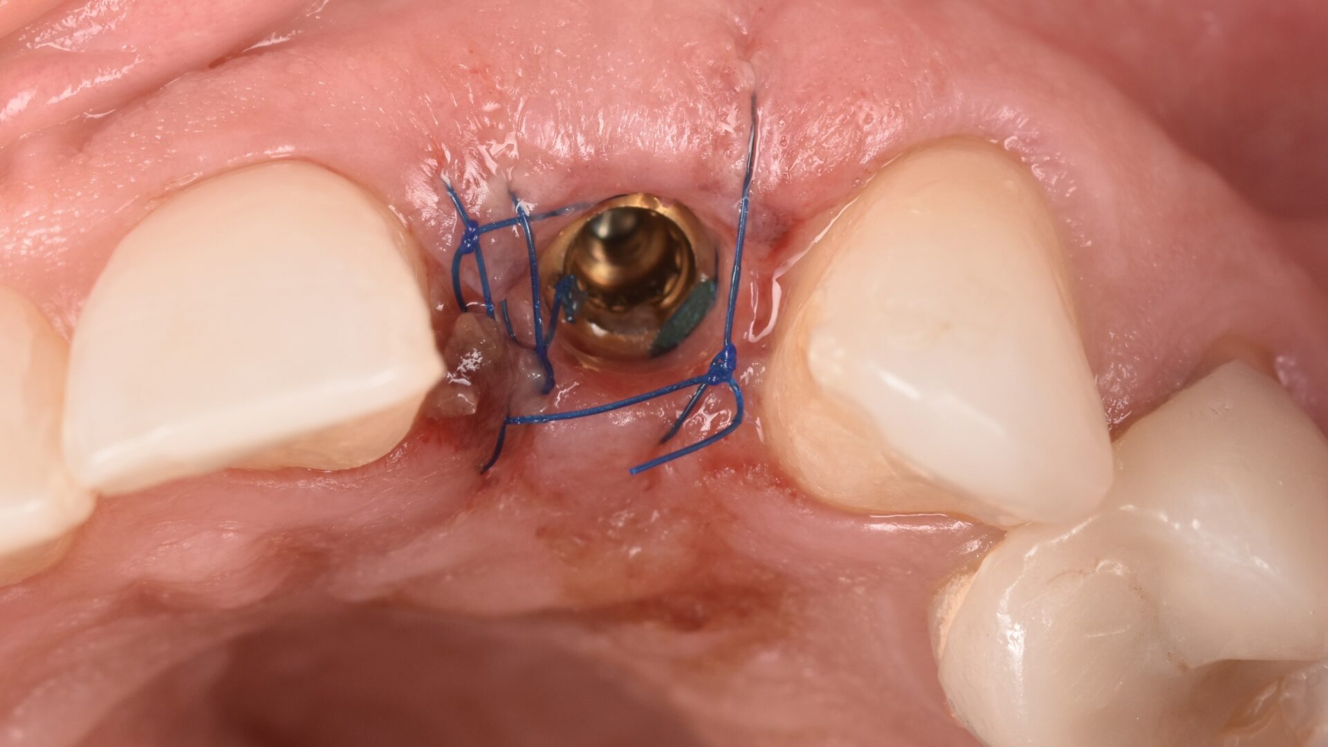 Eirini Zampara Clinical Cases