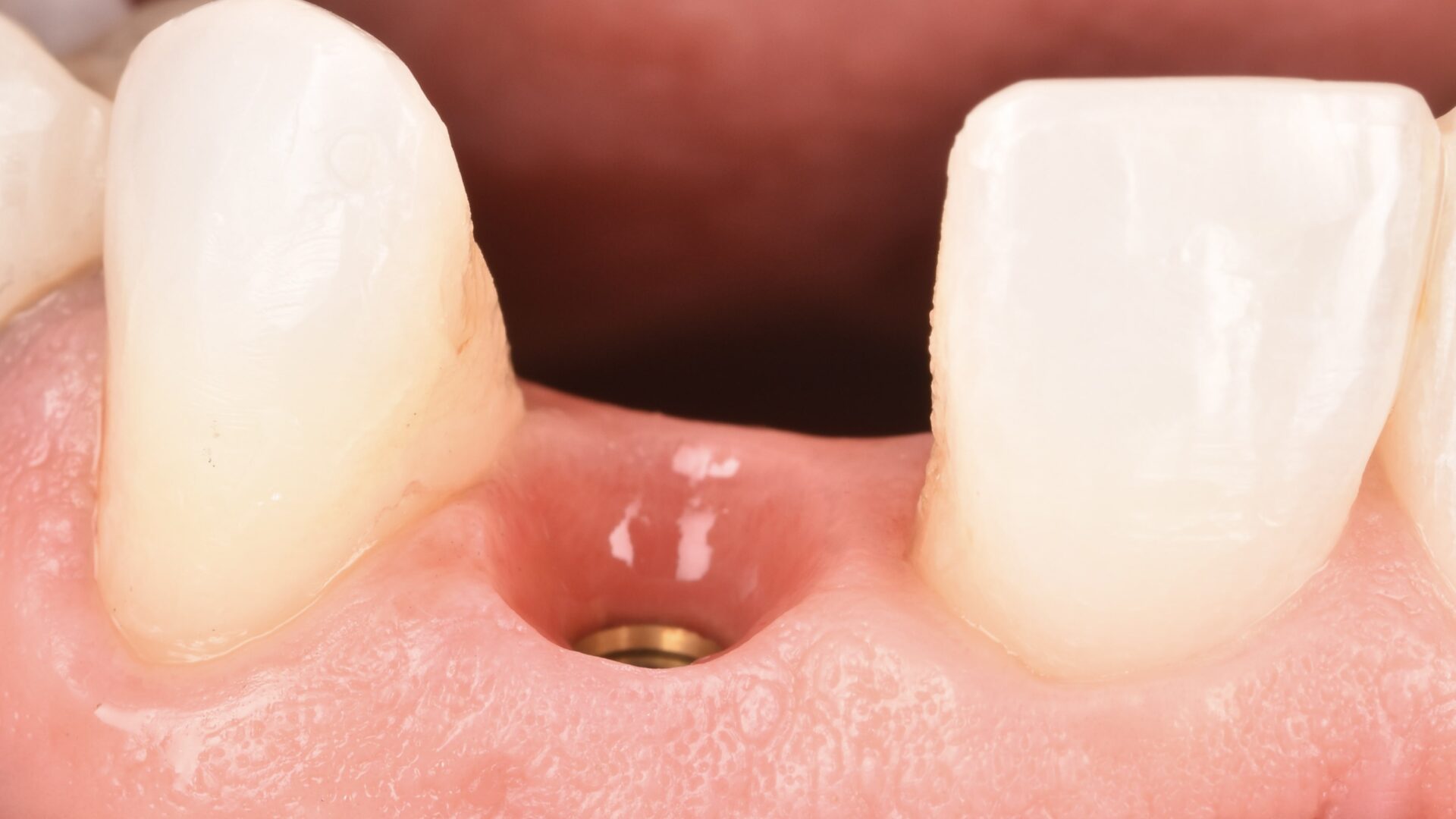 Eirini Zampara Clinical Cases