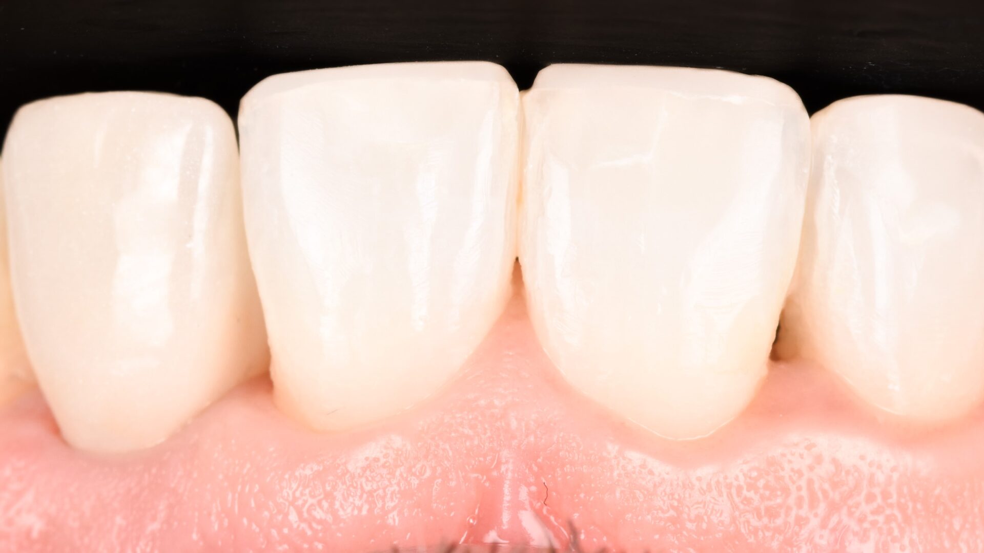 Eirini Zampara Clinical Cases