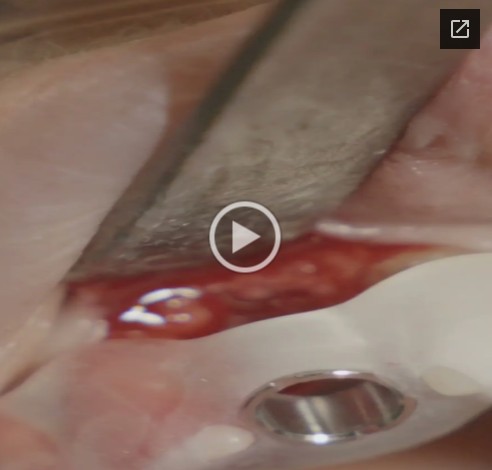 Clinical case video 2