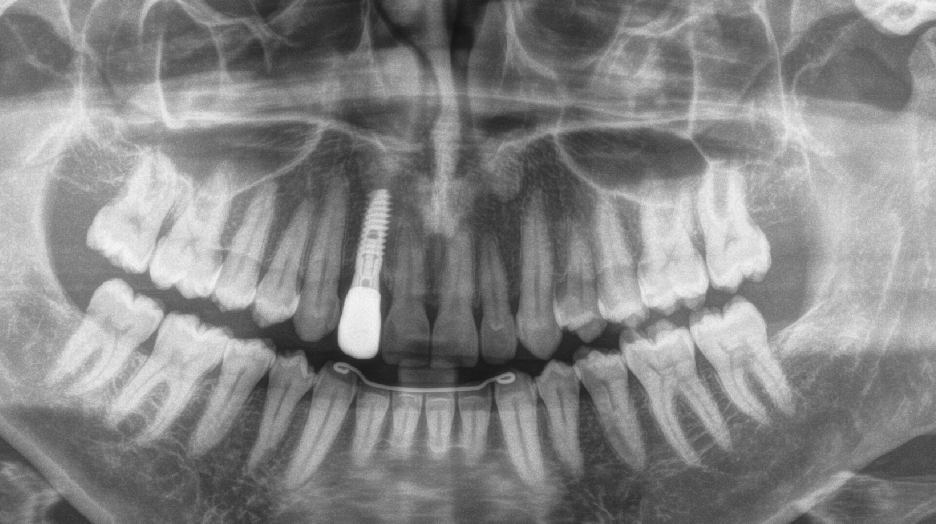 Eirini Zampara Clinical Cases
