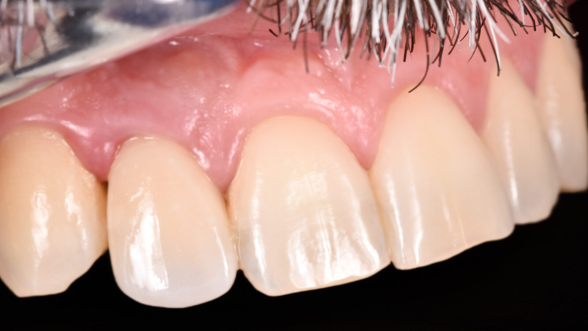 Eirini Zampara Clinical Cases