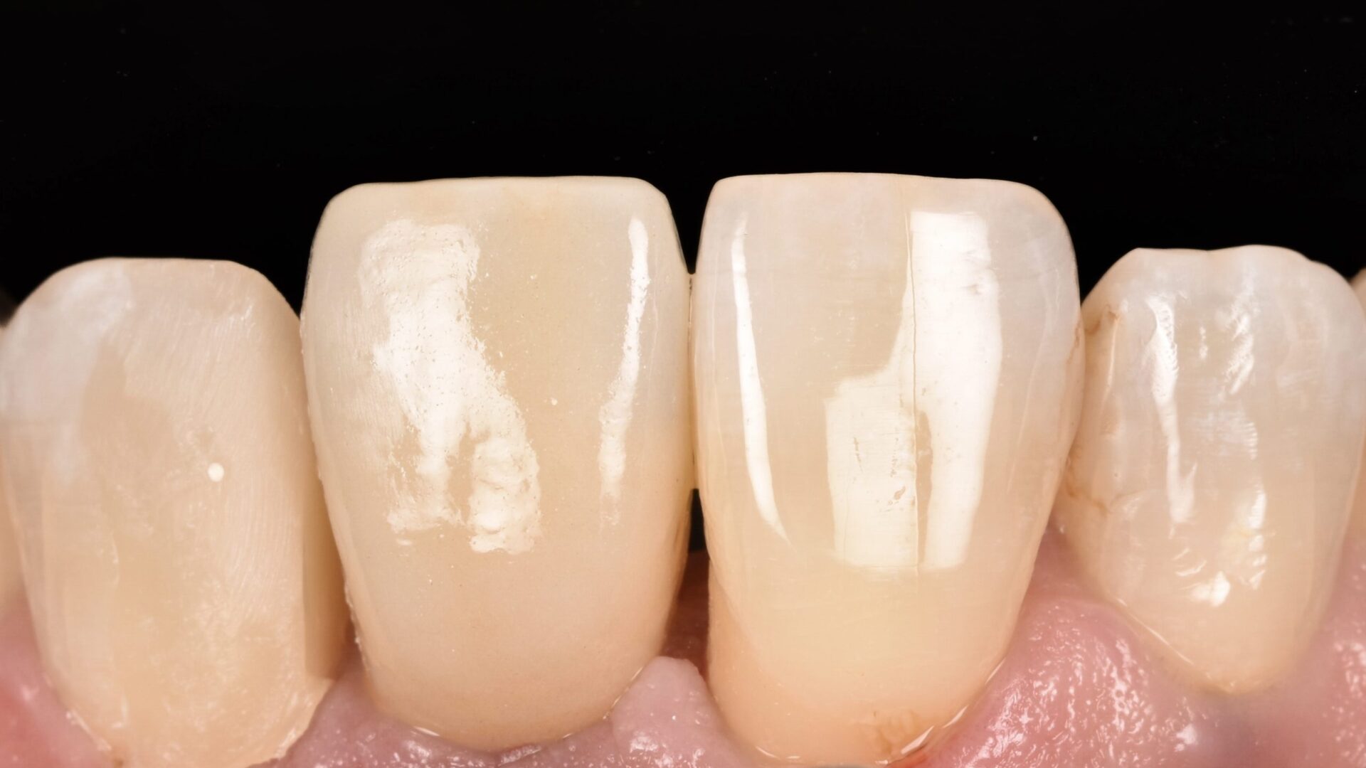 Eirini Zampara Clinical Cases