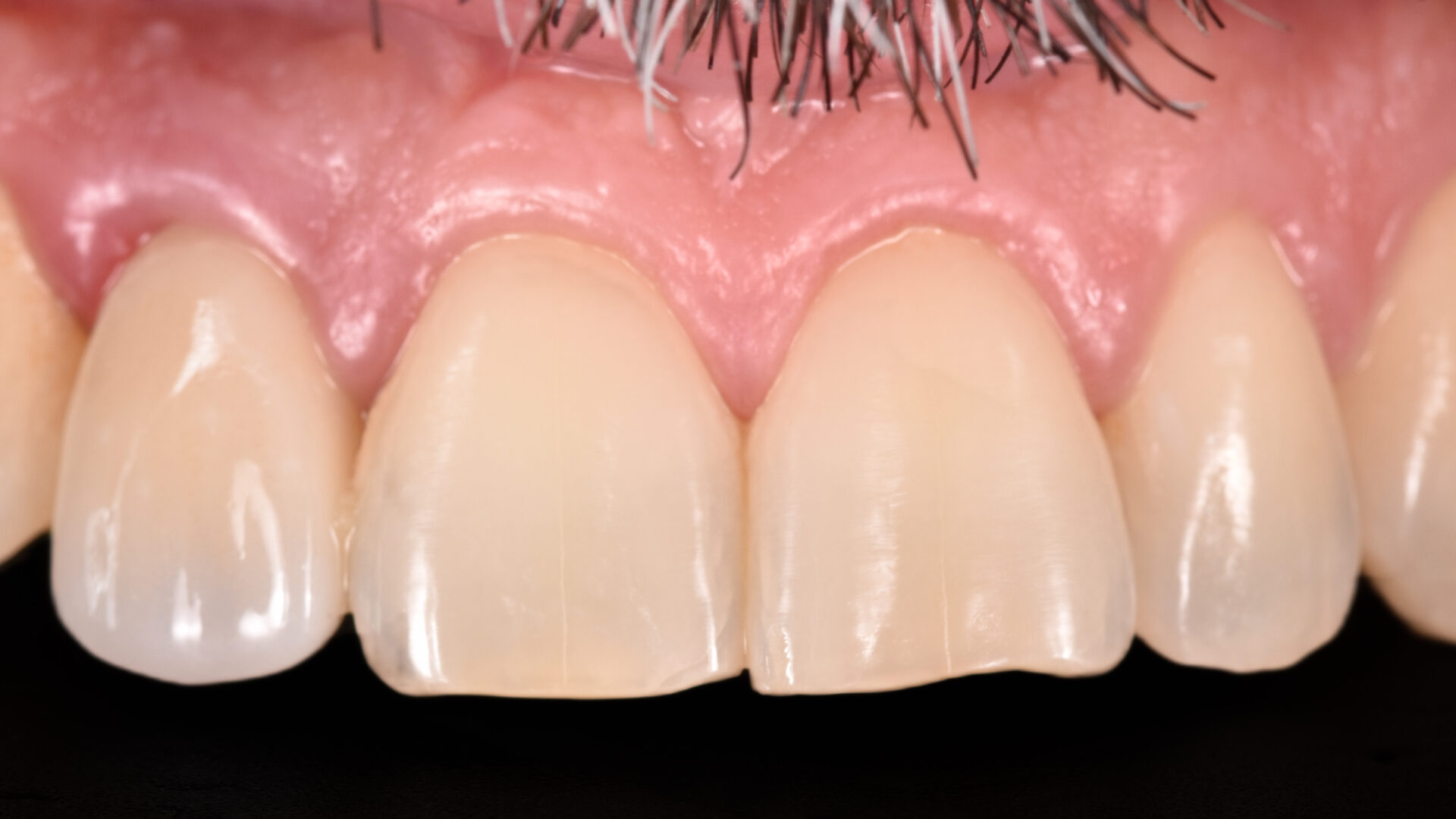 Eirini Zampara Clinical Cases